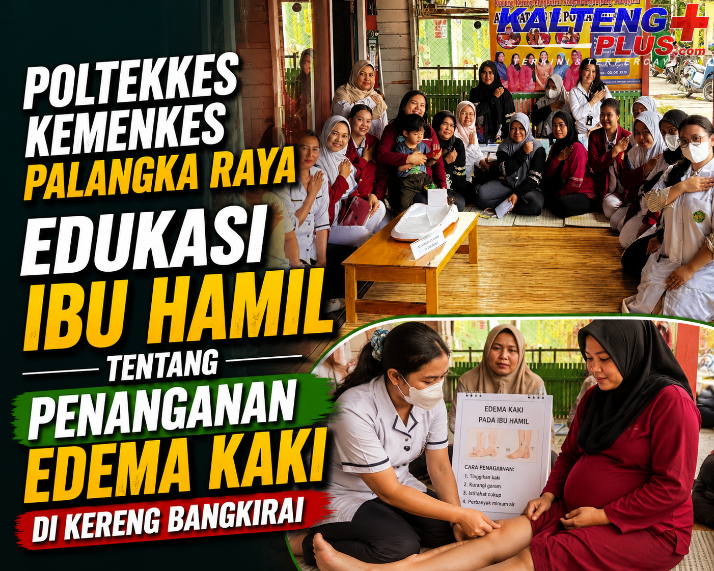 Poltekkes Kemenkes Palangka Raya Edukasi Ibu Hamil tentang Penanganan Edema Kaki di Kereng Bangkirai